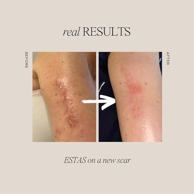 Scar Cream Treatment - Image 4