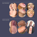 Scar Cream On The Go -Daily Vitamin E & C - Image 2