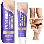 Keloid Bump Removal with Botanical Extracts, Soothing Keloid Bump Cream by Unknown