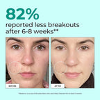 HUM Daily Cleanse Acne Supplements - Image 3