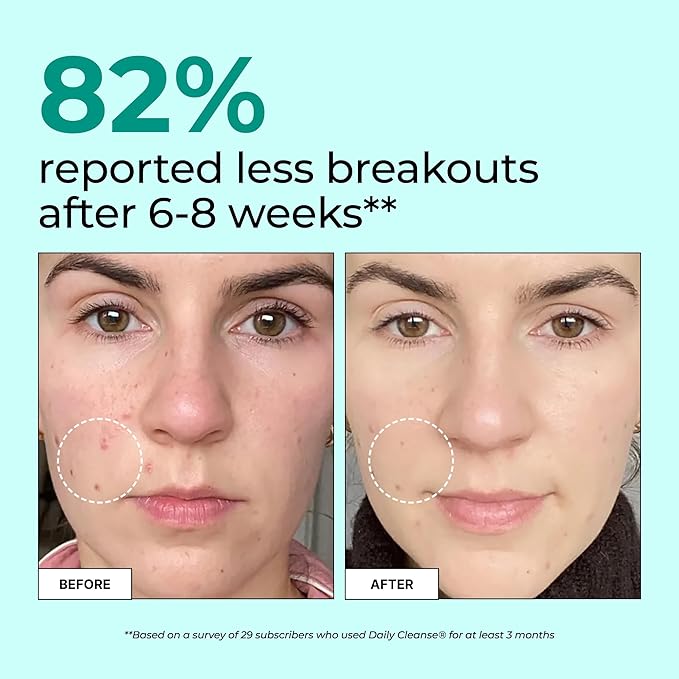 HUM Daily Cleanse Acne Supplements - Image 3