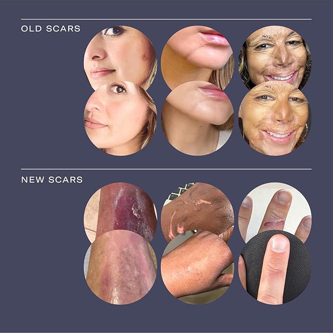 Scar Cream -Daily Vitamin E & C - Image 5