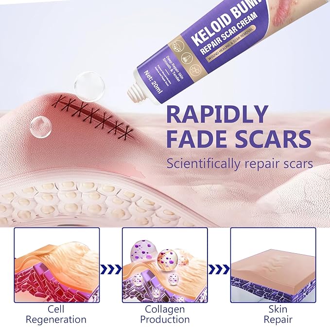 Keloid Bump Removal with Botanical Extracts, Soothing Keloid Bump Cream - Image 4