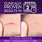 Cicatricure Advanced Scar Gel for Face & Body - Image 3
