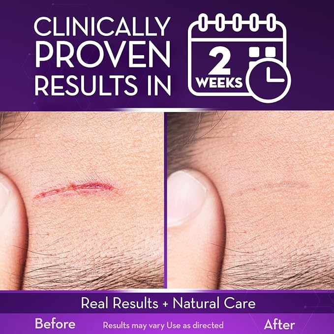 Cicatricure Advanced Scar Gel for Face & Body - Image 3