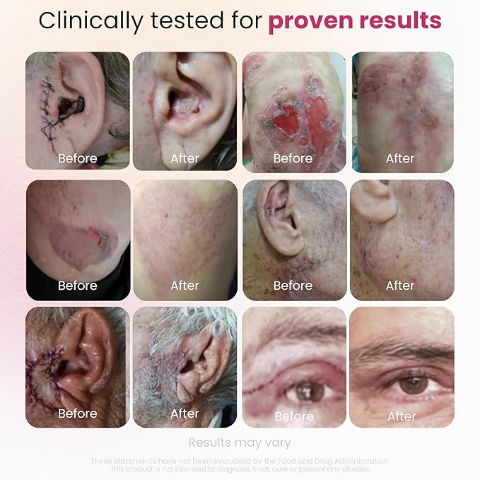 Cica GlocalCare – Clinical-Grade Skin Recovery Supplement – Supports Tissue - Image 4