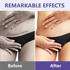 Keloid Bump Removal with Botanical Extracts, Soothing Keloid Bump Cream - Image 6