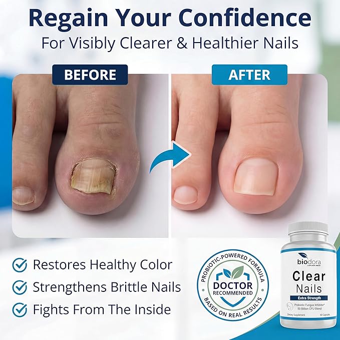 Oral Probiotic Antifungal Pills - Image 3