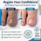 Oral Probiotic Antifungal Pills - Image 3