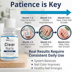 Oral Probiotic Antifungal Pills - Image 6