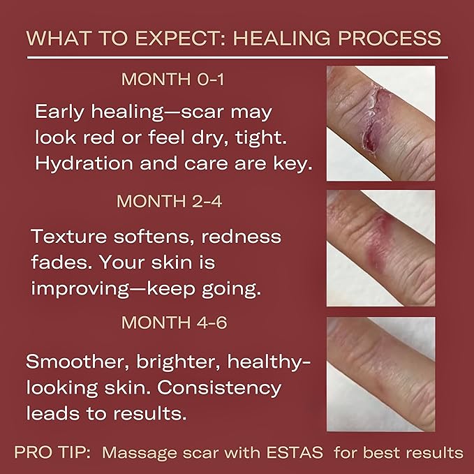 Scar Cream -Daily Vitamin E & C - Image 2