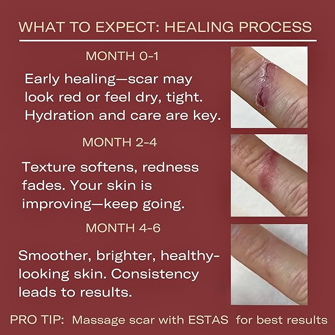 Scar Cream -Daily Vitamin E & C - Image 2